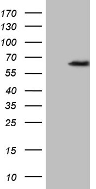 ZNF329 Antibody (OTI2B11) Western Blot;ZNF329 Antibody (OTI2B11)[NBP3-44788]-