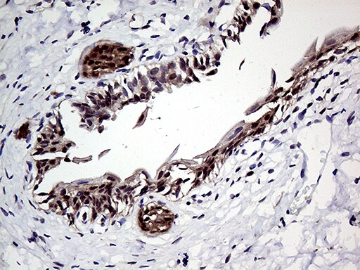 ZNF329 Antibody (OTI7F2) Immunohistochemistry;ZNF329 Antibody (OTI7F2)[NBP3-44789]-