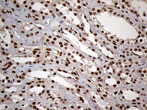 MEIS1 Antibody (OTI3G8) Immunohistochemistry;MEIS1 Antibody (OTI3G8)[NBP3-44792]-