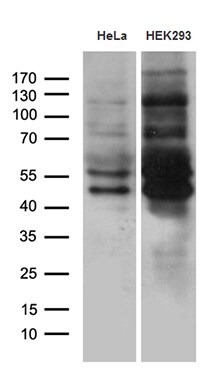 MEIS1 Antibody (OTI3G8) Western Blot;MEIS1 Antibody (OTI3G8)[NBP3-44792]-