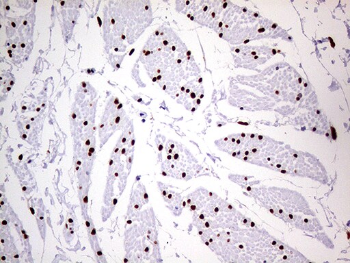 MEIS1 Antibody (OTI2A3) Immunohistochemistry;MEIS1 Antibody (OTI2A3)[NBP3-44793]-