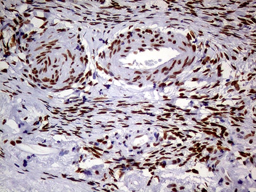 MEIS1 Antibody (OTI2A3) Immunohistochemistry;MEIS1 Antibody (OTI2A3)[NBP3-44793]-