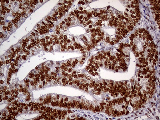 MEIS1 Antibody (OTI2A3) Immunohistochemistry;MEIS1 Antibody (OTI2A3)[NBP3-44793]-