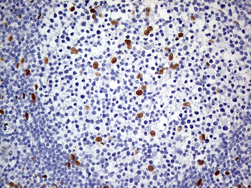 MEIS1 Antibody (OTI2A3) Immunohistochemistry;MEIS1 Antibody (OTI2A3)[NBP3-44793]-