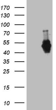 MEIS1 Antibody (OTI2A3) Western Blot;MEIS1 Antibody (OTI2A3)[NBP3-44793]-