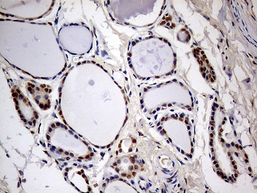 MEIS1 Antibody (OTI3H2) Immunohistochemistry;MEIS1 Antibody (OTI3H2)[NBP3-44796]-