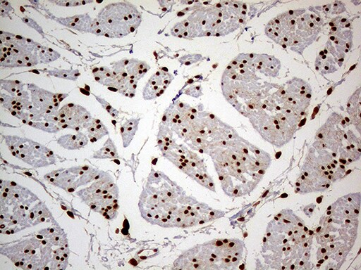 MEIS1 Antibody (OTI3H2) Immunohistochemistry;MEIS1 Antibody (OTI3H2)[NBP3-44796]-