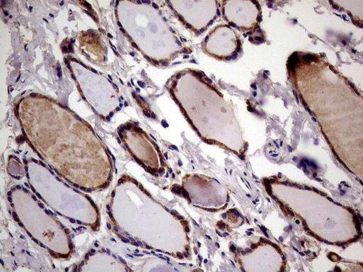 RRBP1 Antibody (OTI3F1) Immunohistochemistry;RRBP1 Antibody (OTI3F1)[NBP3-44798]-