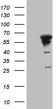 Myotilin Antibody (OTI10A11) Western Blot;Myotilin Antibody (OTI10A11)[NBP3-44800]-