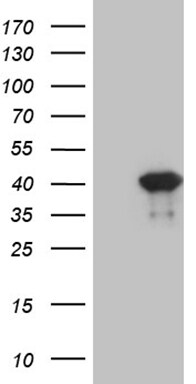 PITX2 Antibody (OTI1H10) Western Blot;PITX2 Antibody (OTI1H10)[NBP3-44803]-