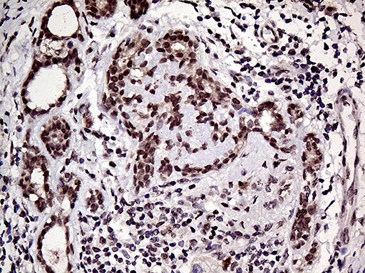 HOXD9 Antibody (OTI1H3) Immunohistochemistry;HOXD9 Antibody (OTI1H3)[NBP3-44805]-