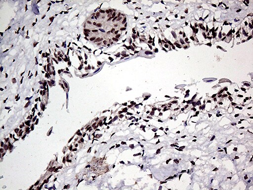 HOXD9 Antibody (OTI1H3) Immunohistochemistry;HOXD9 Antibody (OTI1H3)[NBP3-44805]-