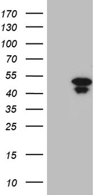 HOXD9 Antibody (OTI1H3) Western Blot;HOXD9 Antibody (OTI1H3)[NBP3-44805]-