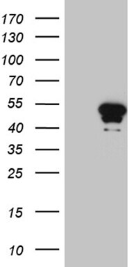 HOXD9 Antibody (OTI10G8) Western Blot;HOXD9 Antibody (OTI10G8)[NBP3-44806]-