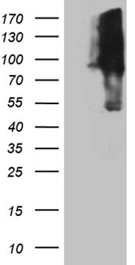 KIF9 Antibody (OTI1A2) Western Blot;KIF9 Antibody (OTI1A2)[NBP3-44807]-