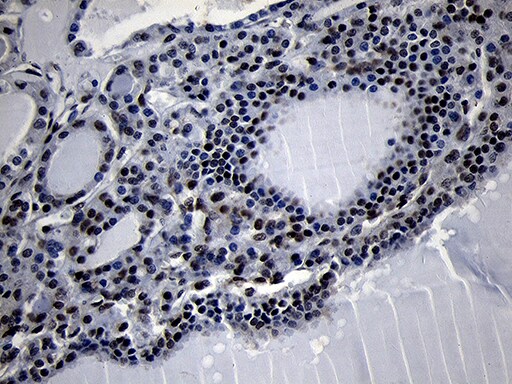 HOXC4 Antibody (OTI1F6) Immunohistochemistry;HOXC4 Antibody (OTI1F6)[NBP3-44809]-