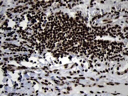 HOXC4 Antibody (OTI1F6) Immunohistochemistry;HOXC4 Antibody (OTI1F6)[NBP3-44809]-