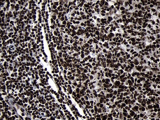 HOXC4 Antibody (OTI1F6) Immunohistochemistry;HOXC4 Antibody (OTI1F6)[NBP3-44809]-
