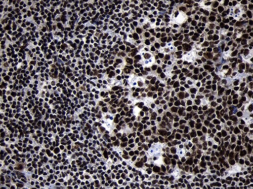 HOXC4 Antibody (OTI2D5) Immunohistochemistry;HOXC4 Antibody (OTI2D5)[NBP3-44812]-