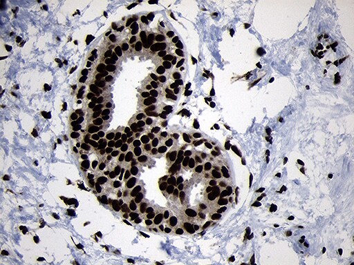 HOXC4 Antibody (OTI2D5) Immunohistochemistry;HOXC4 Antibody (OTI2D5)[NBP3-44812]-