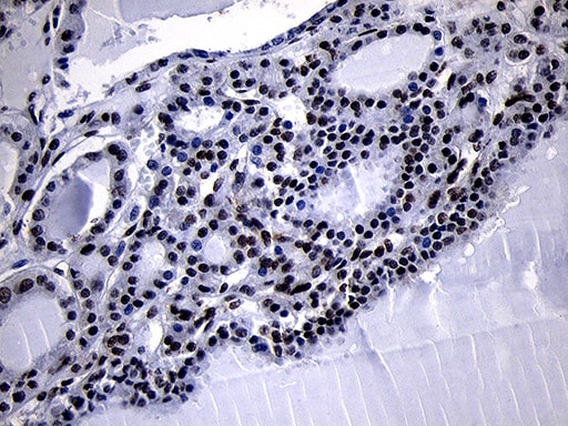 HOXC4 Antibody (OTI2D5) Immunohistochemistry;HOXC4 Antibody (OTI2D5)[NBP3-44812]-