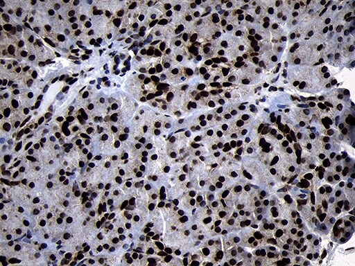 HOXC4 Antibody (OTI2D5) Immunohistochemistry;HOXC4 Antibody (OTI2D5)[NBP3-44812]-