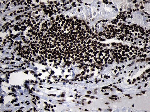 HOXC4 Antibody (OTI2D5) Immunohistochemistry;HOXC4 Antibody (OTI2D5)[NBP3-44812]-