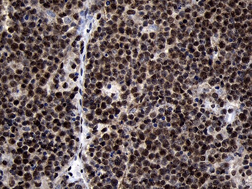 HOXC4 Antibody (OTI2D5) Immunohistochemistry;HOXC4 Antibody (OTI2D5)[NBP3-44812]-