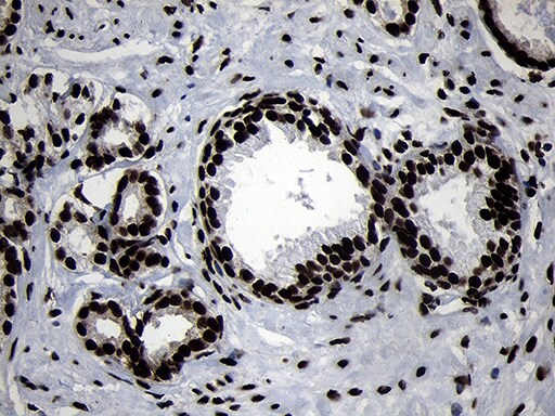 HOXC4 Antibody (OTI2D5) Immunohistochemistry;HOXC4 Antibody (OTI2D5)[NBP3-44812]-