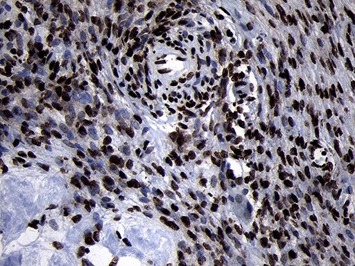 HOXC4 Antibody (OTI2D5) Immunohistochemistry;HOXC4 Antibody (OTI2D5)[NBP3-44812]-