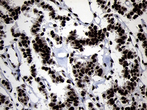 HOXC4 Antibody (OTI2D5) Immunohistochemistry;HOXC4 Antibody (OTI2D5)[NBP3-44812]-