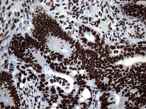 SH3BGRL Antibody (OTI8F7) Immunohistochemistry;SH3BGRL Antibody (OTI8F7)[NBP3-44815]-