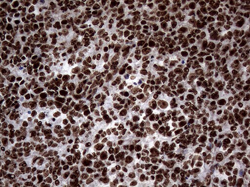 SH3BGRL Antibody (OTI8F7) Immunohistochemistry;SH3BGRL Antibody (OTI8F7)[NBP3-44815]-