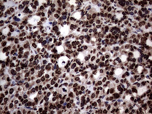 SH3BGRL Antibody (OTI8F7) Immunohistochemistry;SH3BGRL Antibody (OTI8F7)[NBP3-44815]-