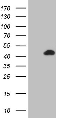 BCL7B Antibody (OTI8E10) Western Blot;BCL7B Antibody (OTI8E10)[NBP3-44816]-