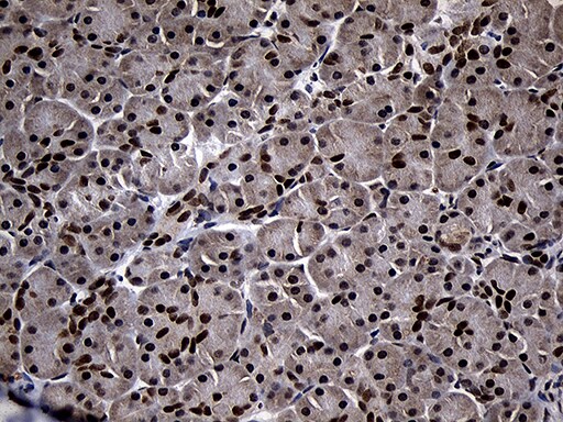 SUPT16H Antibody (OTI3B8) Immunohistochemistry;SUPT16H Antibody (OTI3B8)[NBP3-44820]-