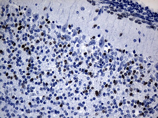 PHF20L1 Antibody (OTI1F4) Immunohistochemistry;PHF20L1 Antibody (OTI1F4)[NBP3-44825]-