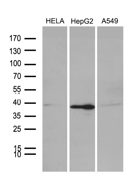 PHF20L1 Antibody (OTI1F4) Western Blot;PHF20L1 Antibody (OTI1F4)[NBP3-44825]-