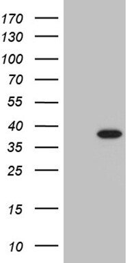 PHF20L1 Antibody (OTI1F4) Western Blot;PHF20L1 Antibody (OTI1F4)[NBP3-44825]-