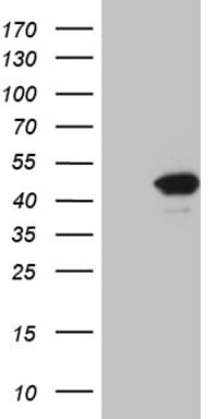 FBXO22 Antibody (OTI1H1) Western Blot;FBXO22 Antibody (OTI1H1)[NBP3-44826]-