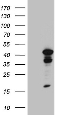TIN2 Antibody (OTI2C12) Western Blot;TIN2 Antibody (OTI2C12)[NBP3-44828]-