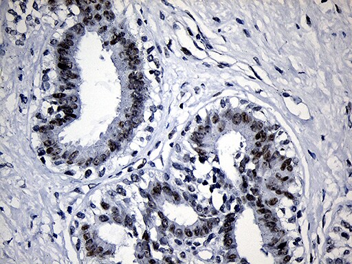 SUPT16H Antibody (OTI8A1) Immunohistochemistry;SUPT16H Antibody (OTI8A1)[NBP3-44829]-