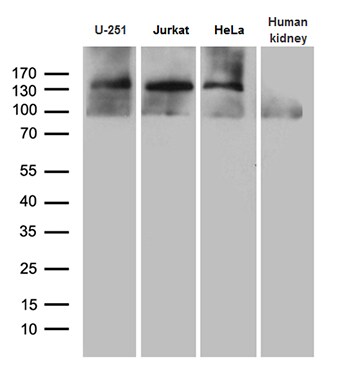 SUPT16H Antibody (OTI8A1) Western Blot;SUPT16H Antibody (OTI8A1)[NBP3-44829]-