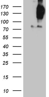 FYCO1 Antibody (OTI9D1) Western Blot;FYCO1 Antibody (OTI9D1)[NBP3-44830]-