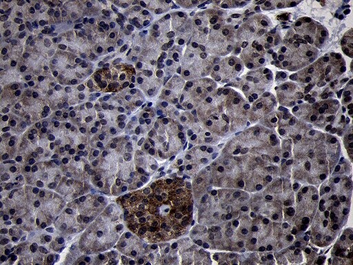 USP40 Antibody (OTI2C5) Immunohistochemistry;USP40 Antibody (OTI2C5)[NBP3-44832]-
