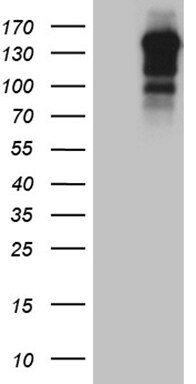 USP40 Antibody (OTI2C5) Western Blot;USP40 Antibody (OTI2C5)[NBP3-44832]-