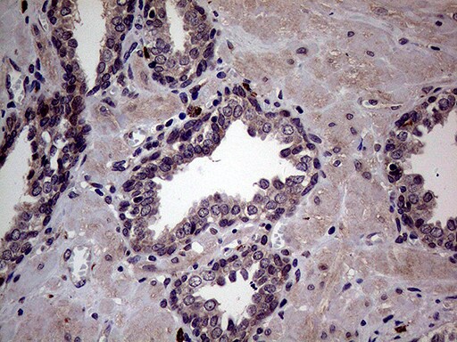 JIP1 Antibody (OTI1D9) Immunohistochemistry;JIP1 Antibody (OTI1D9)[NBP3-44838]-
