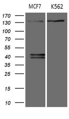 USP40 Antibody (OTI8F8) Western Blot;USP40 Antibody (OTI8F8)[NBP3-44842]-