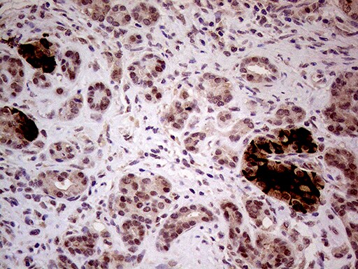 INPP5F Antibody (OTI1D4) Immunohistochemistry;INPP5F Antibody (OTI1D4)[NBP3-44844]-