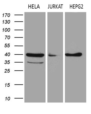 LSM11 Antibody (OTI1H1) Western Blot;LSM11 Antibody (OTI1H1)[NBP3-44846]-